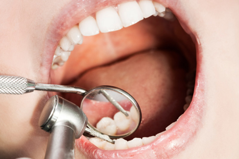 what do your gums reveal about your health