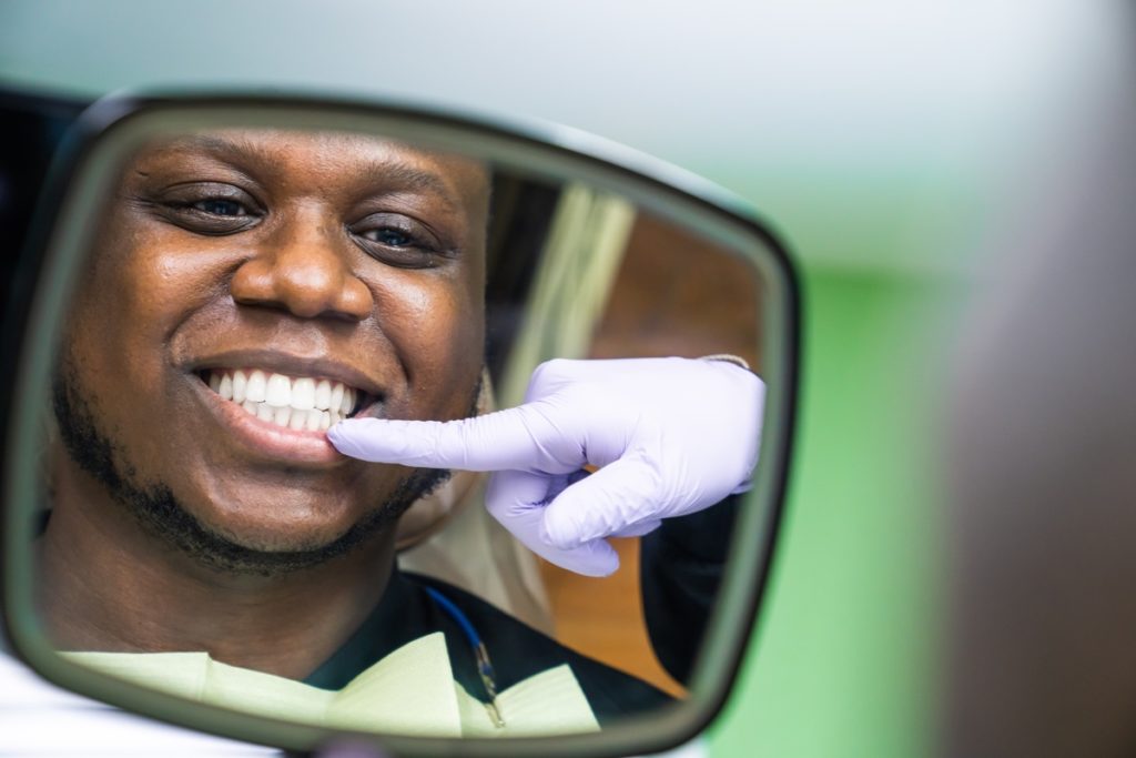 a dental patient smiling in a mirror