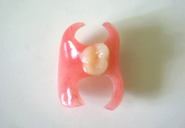 Removable denture type Butterfly