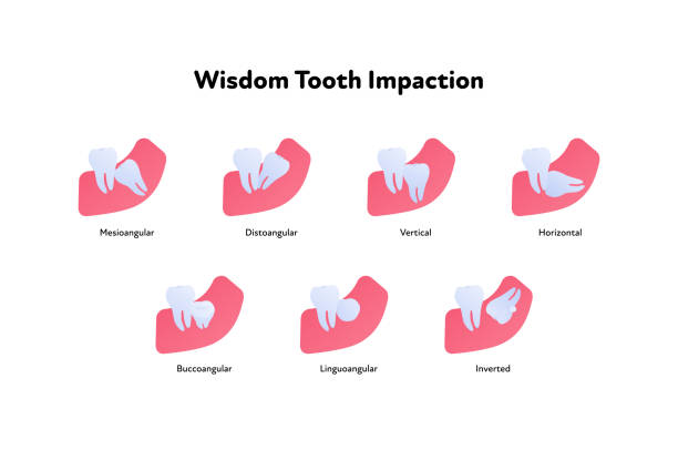 Tooth anatomy chart